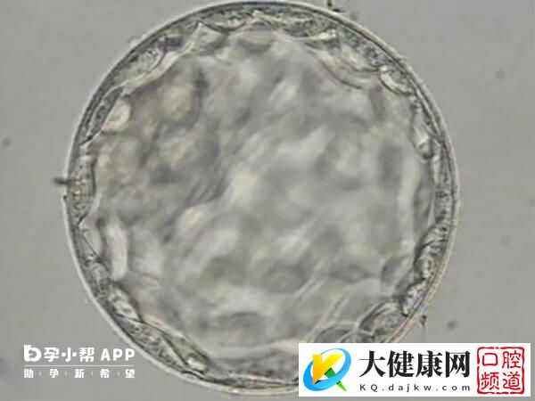 胚胎质量有问题的因素很多